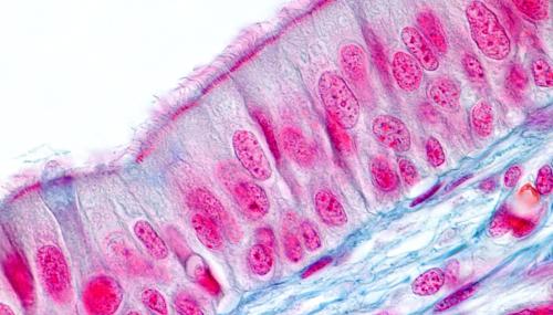 Epithelial cells