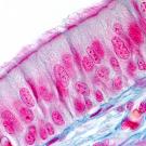 Respiratory epithelial cells