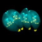 Toxoplasma gondii (Wikimedia Commons)