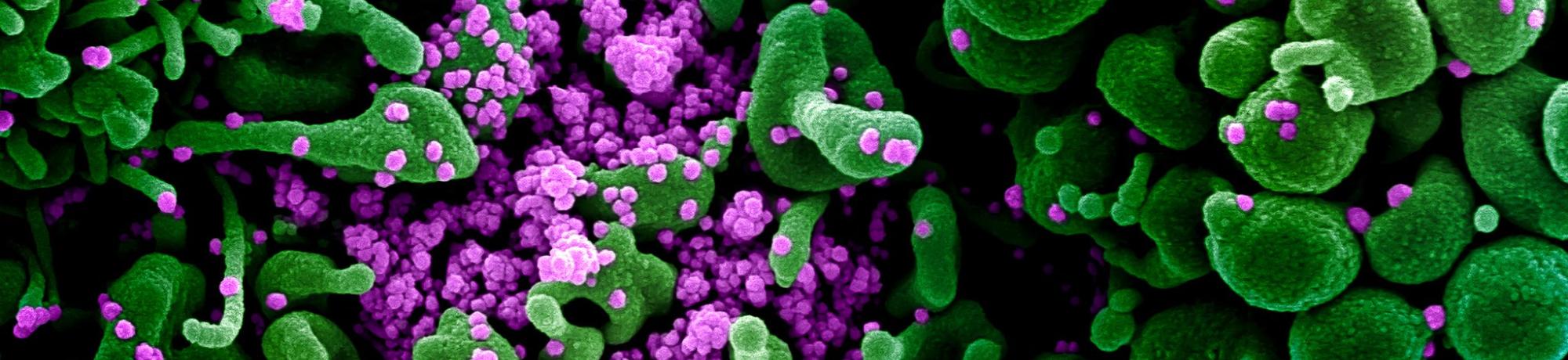 Coronavirus under a microscope (Photo credit: NIAID)