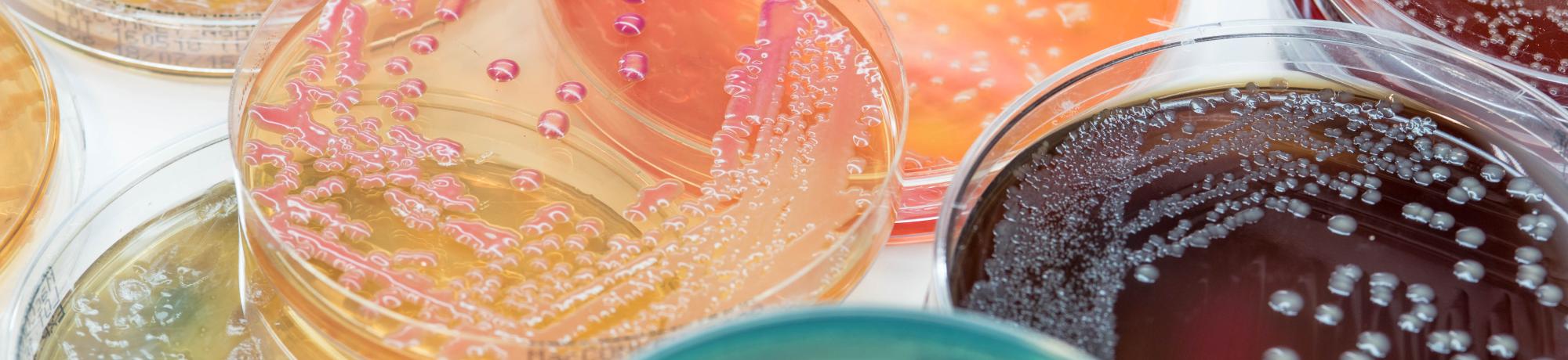 Colorful microbiology plates