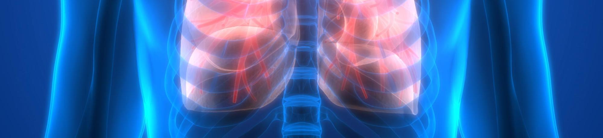 Lung Xray